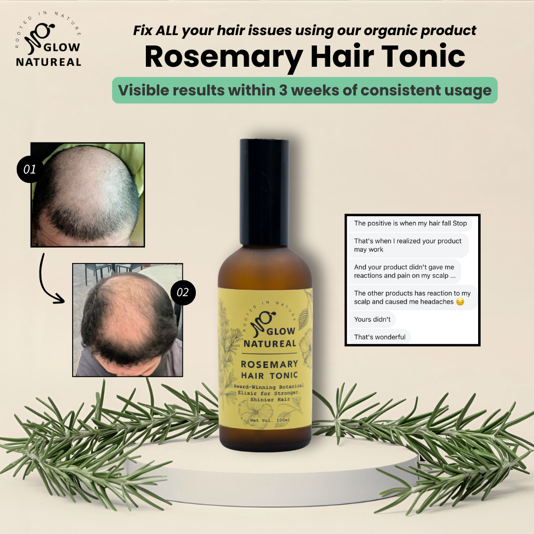 Rosemary Hair Growth Tonic, 100 ml