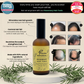 Rosemary Hair Tonic